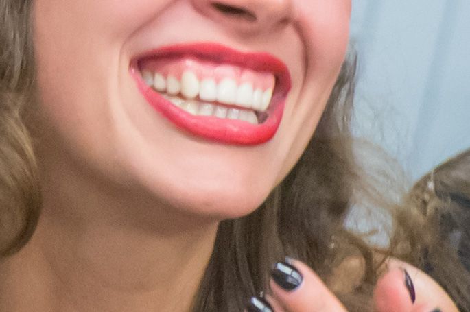 Snow-white smile: how to whiten teeth at home - products that will help teeth