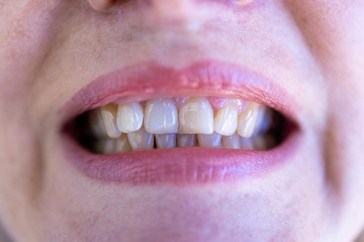 How to Brush Your Teeth Properly: Secrets of a Regular Procedure teeth