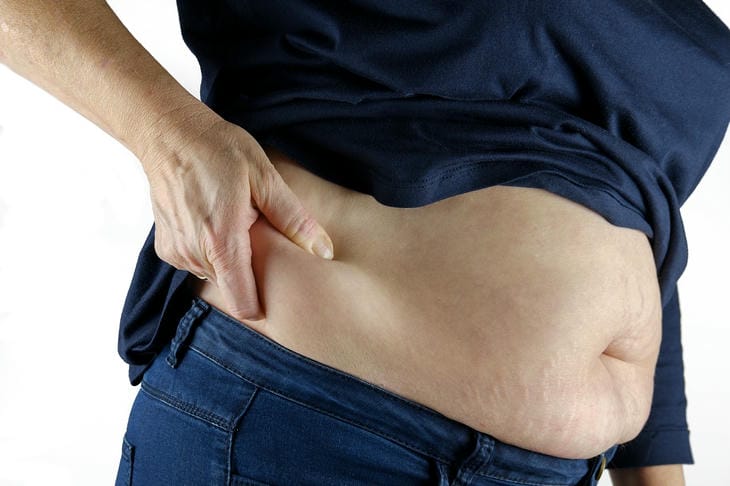 Perfect Skin Without Stretch Marks: How to Achieve It body